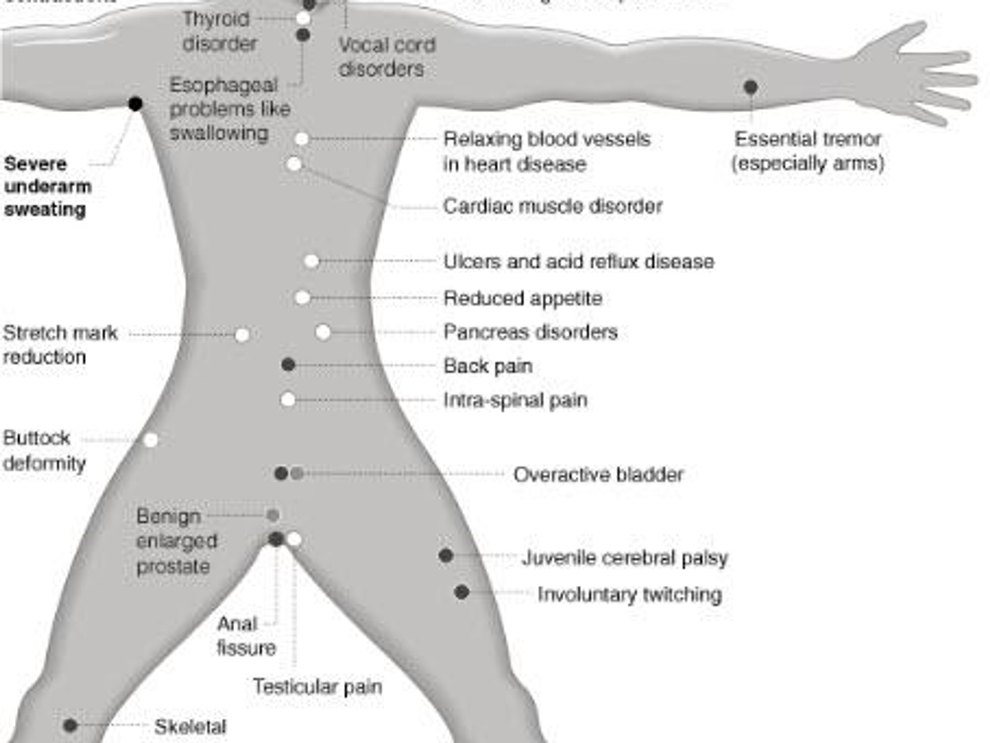 Austin Photo: News_Jennifer Walden_botox_July 2012