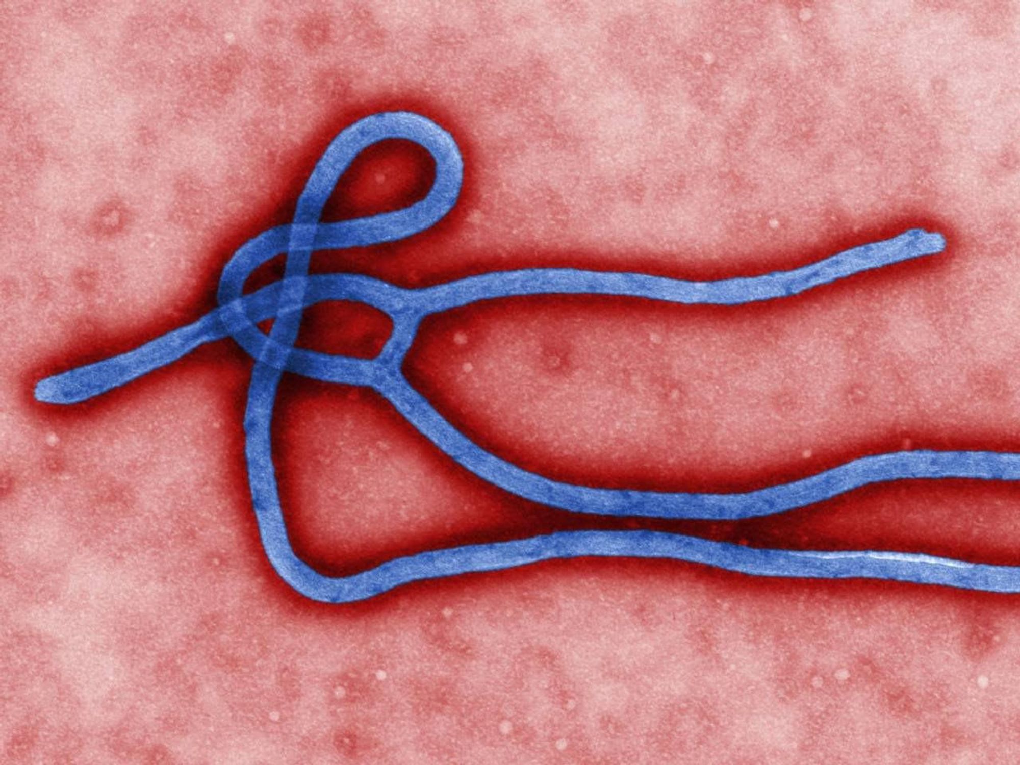 Ebola virus