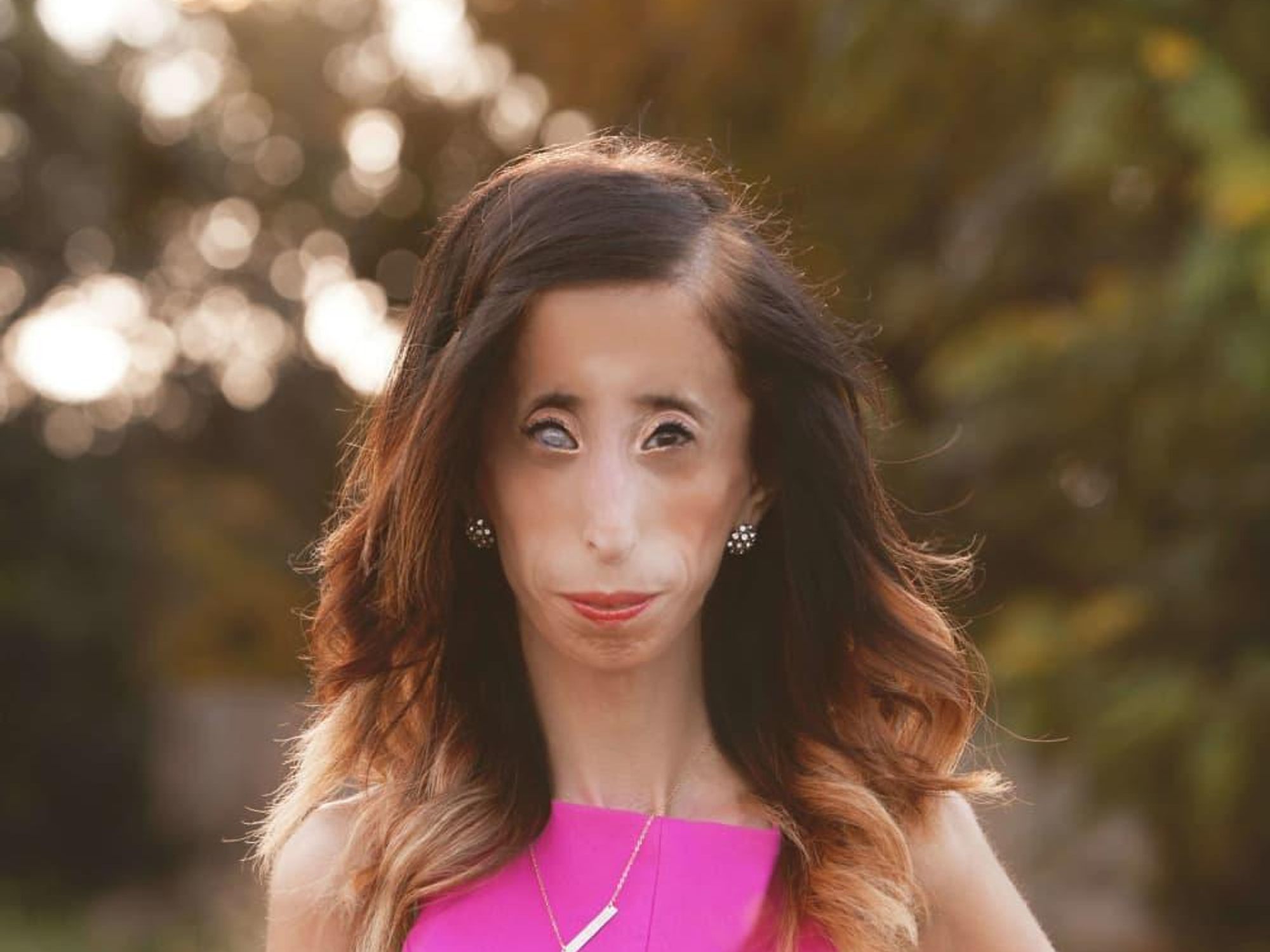 Lizzie Velasquez Top Texans Under 30